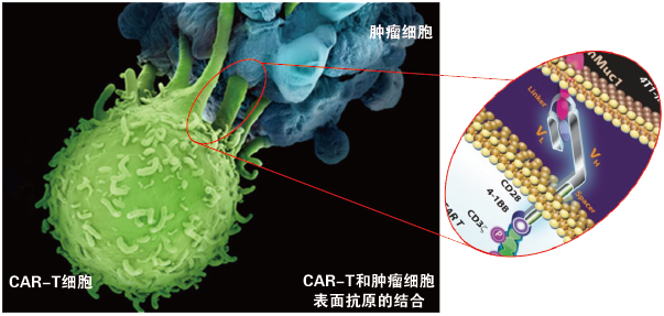 CAR-T00.png